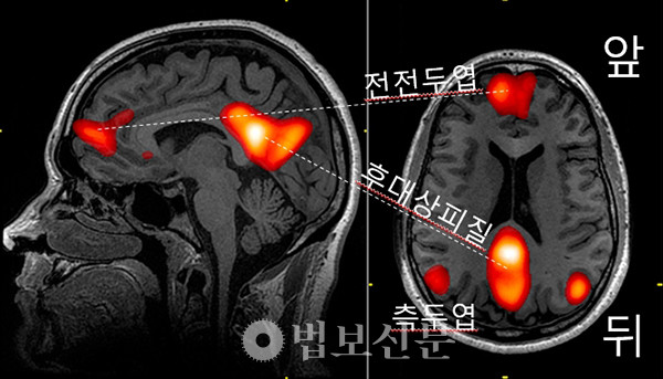 기본모드 신경망의 활성을 보여주는 fMRI 사진.